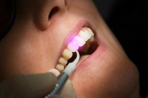 Laser ermöglicht dem Zahnarzt eine effiziente, schnelle und schonende Behandlung.