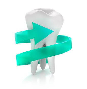 Um lange Freude an Ihrem Zahnersatz zu haben, lassen Sie regelmäßig eine professionelle Zahnreinigung durchführen